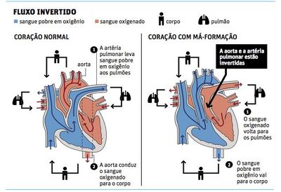 Transposicaodegrandesvasos.jpg